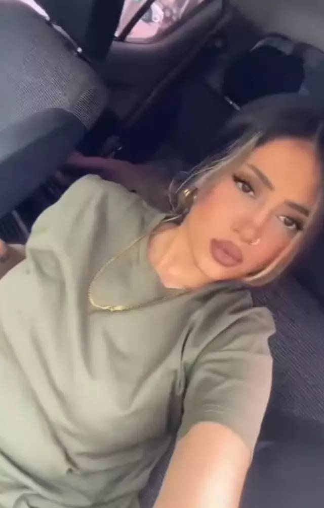 Seda Sayan’ın favori gelin adayı Solmaz Çiros’un son hali ortaya çıktı. Gören ‘bu bizim izlediğimiz kız mı’ dedi - Resim: 10